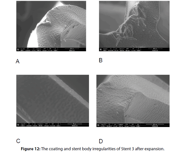 interventional-cardiology-coating-stent