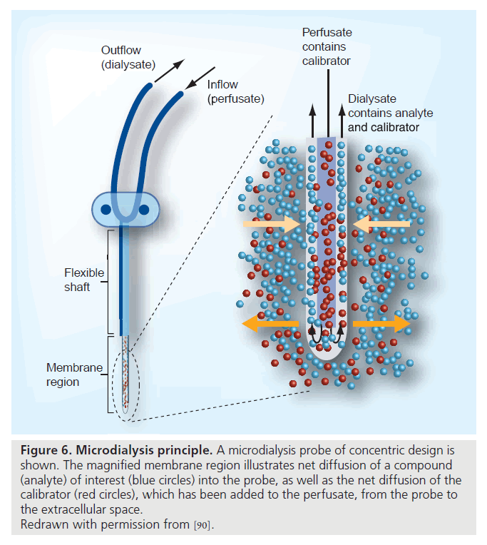 interventional-cardiology-concentric-design