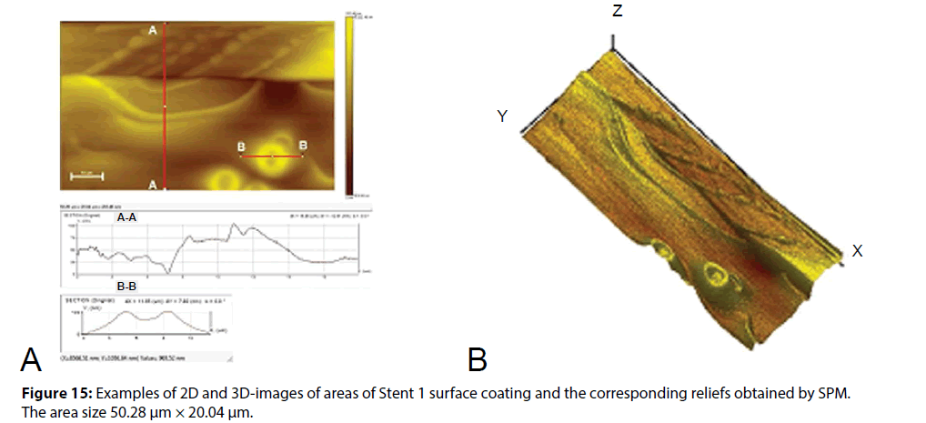 interventional-cardiology-corresponding-reliefs