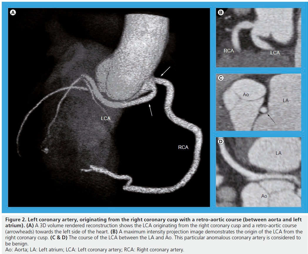 interventional-cardiology-course