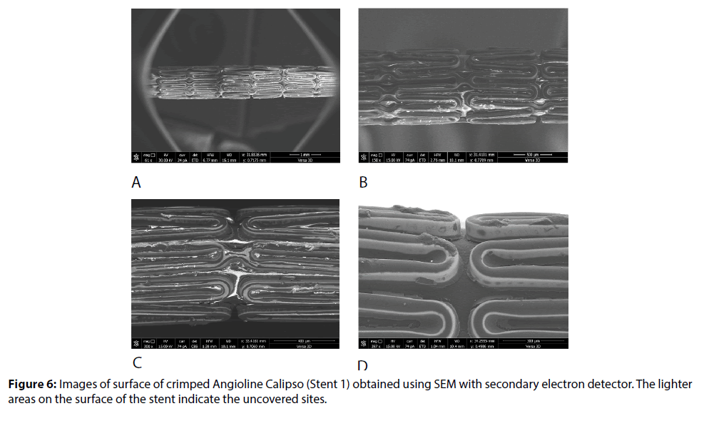 interventional-cardiology-crimped-Angioline