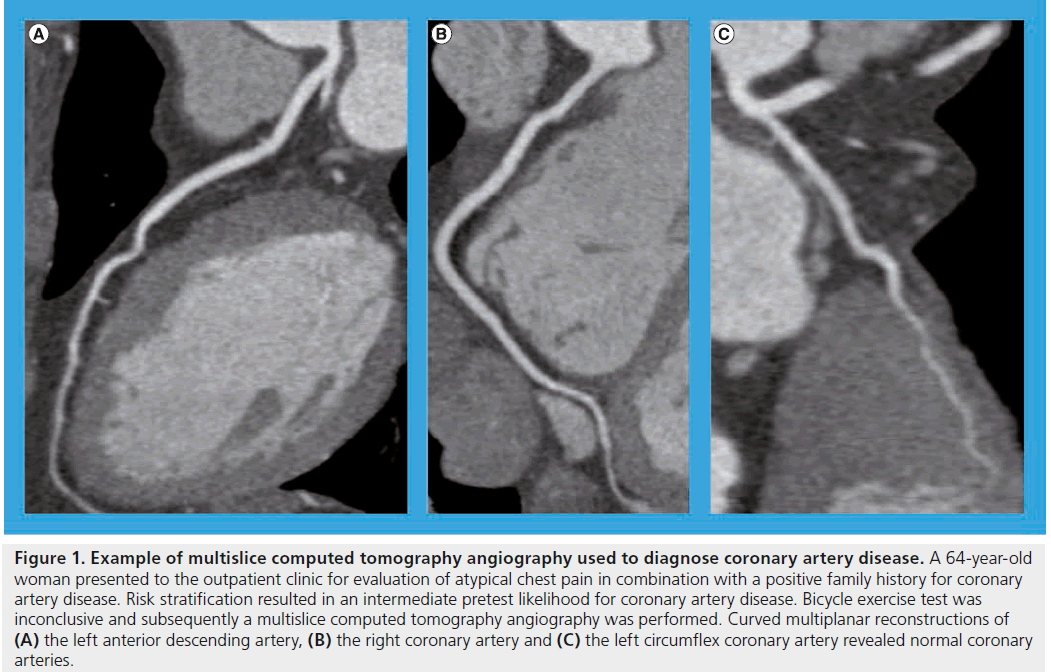 interventional-cardiology-diagnose