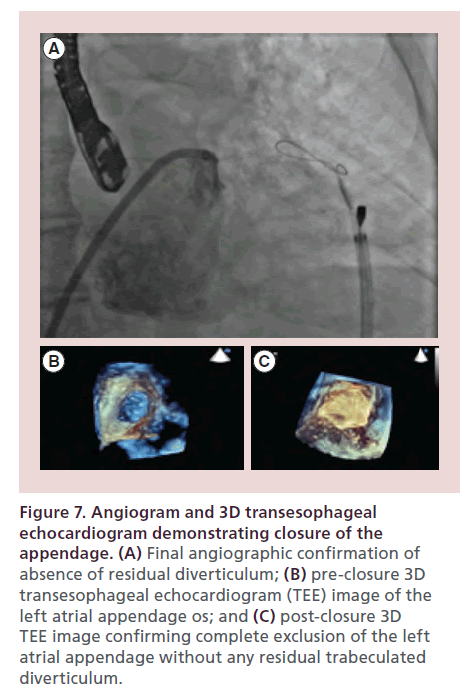 interventional-cardiology-echocardiogram-demonstrating