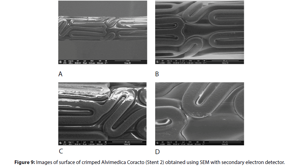 interventional-cardiology-electron-detector