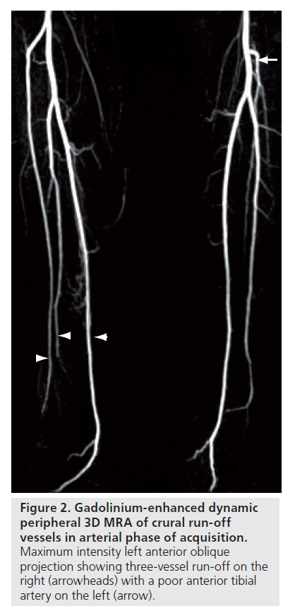 interventional-cardiology-enhanced-dynamic