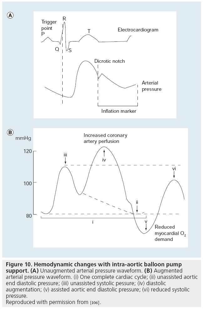 interventional-cardiology-hemodynamic