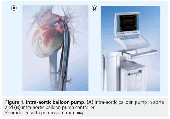 interventional-cardiology-intra-aortic