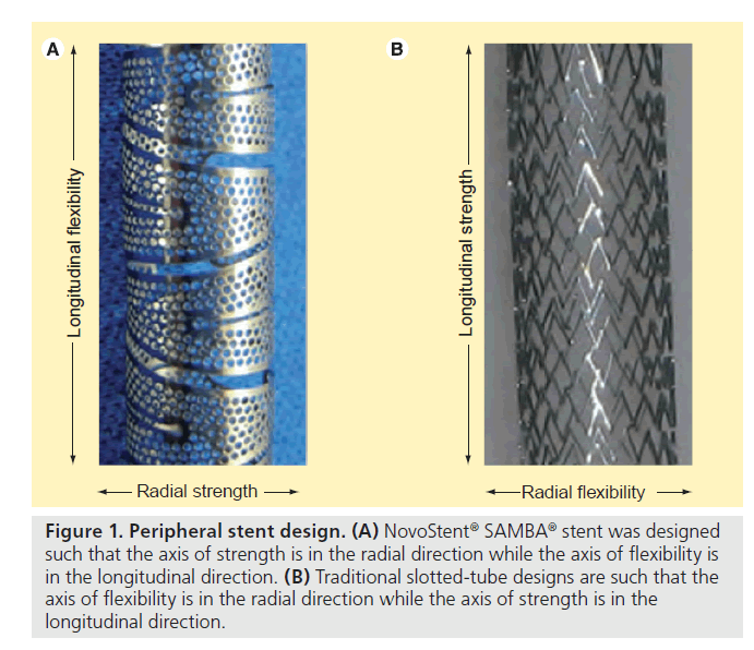 interventional-cardiology-longitudinal-direction