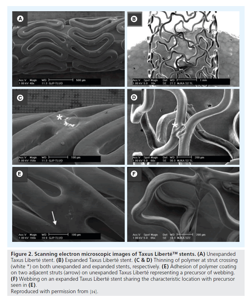 interventional-cardiology-microscopic-images