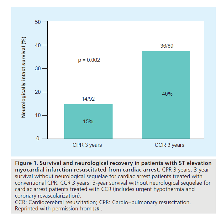 interventional-cardiology-neurological