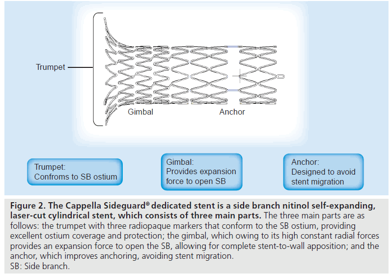 interventional-cardiology-nitinol