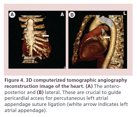 interventional-cardiology-reconstruction-image