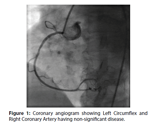 interventional-cardiology-significant-disease