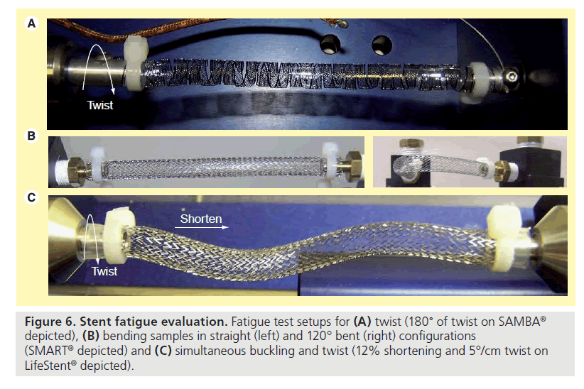 interventional-cardiology-simultaneous-buckling