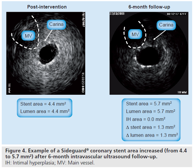 interventional-cardiology-ultrasound